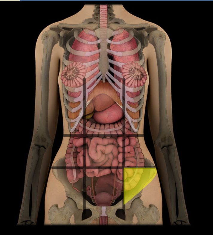 term image