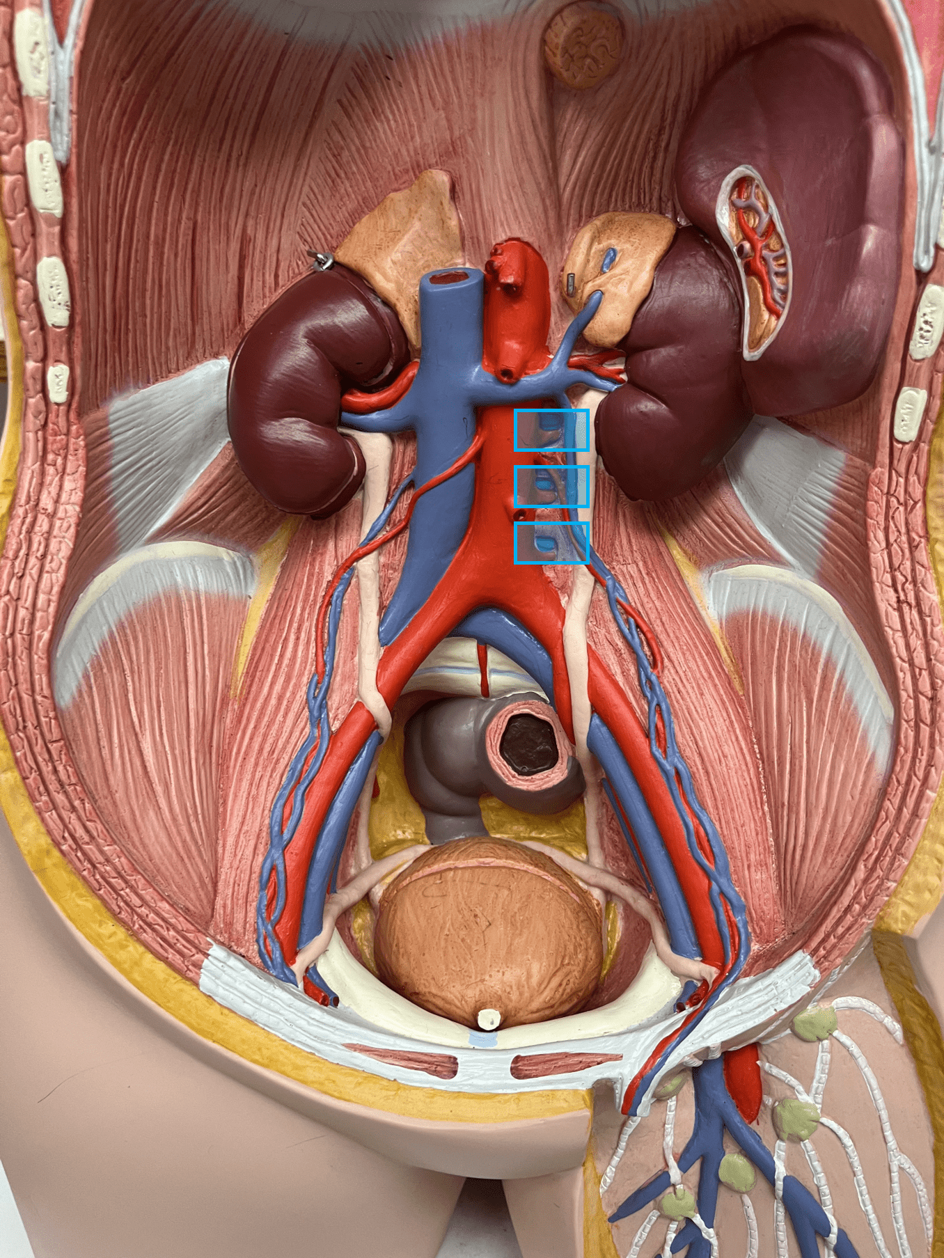 <p>• A vein of the abdomen.</p>
<p>• Drains the spinal cord and body wall.</p>
<p>• Empties into the inferior vena cava.</p>
<p>• On the inferior vena cava, inferior to the gonadal veins.</p>