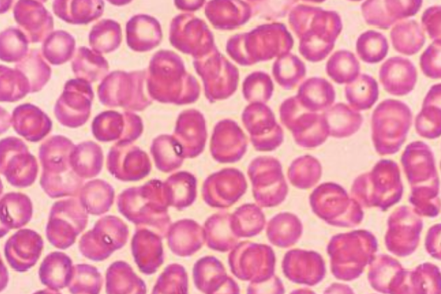 <p>Identify these cells.</p>