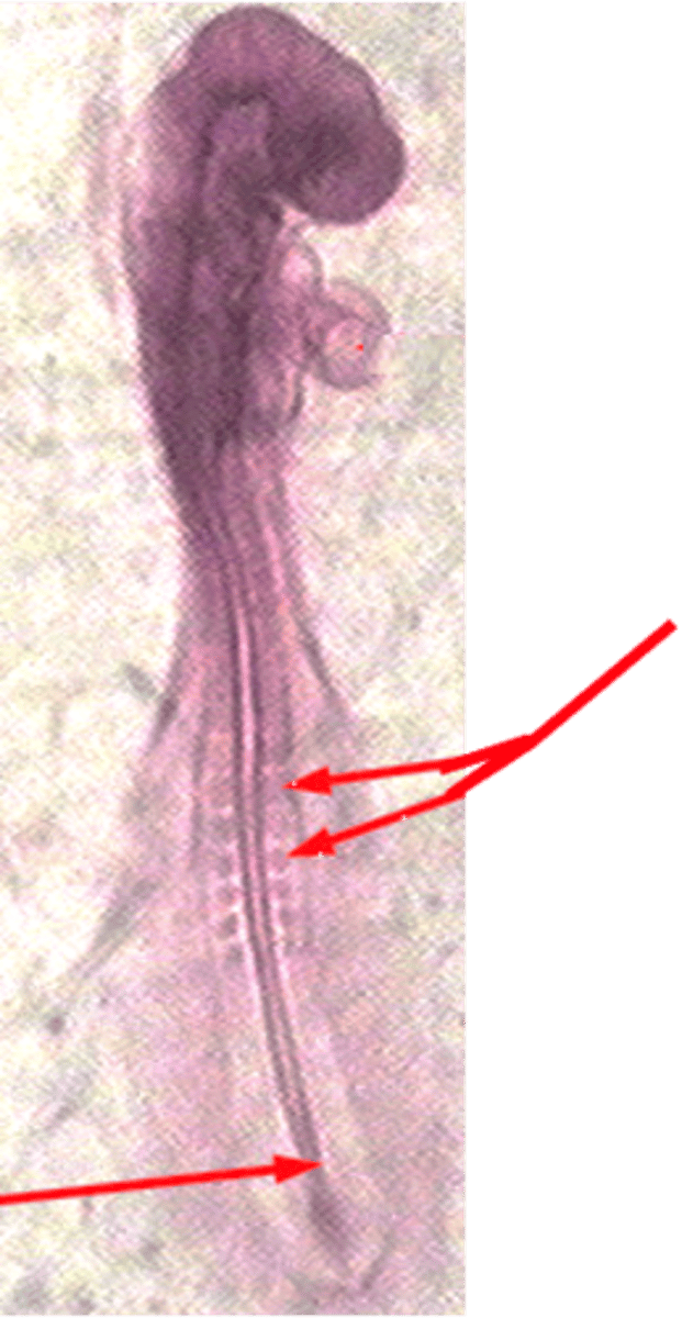 <p>What are somites and what do they do?</p>