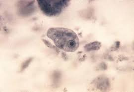 <p>in human stool</p><p>no symptoms</p><p>worldwide</p>