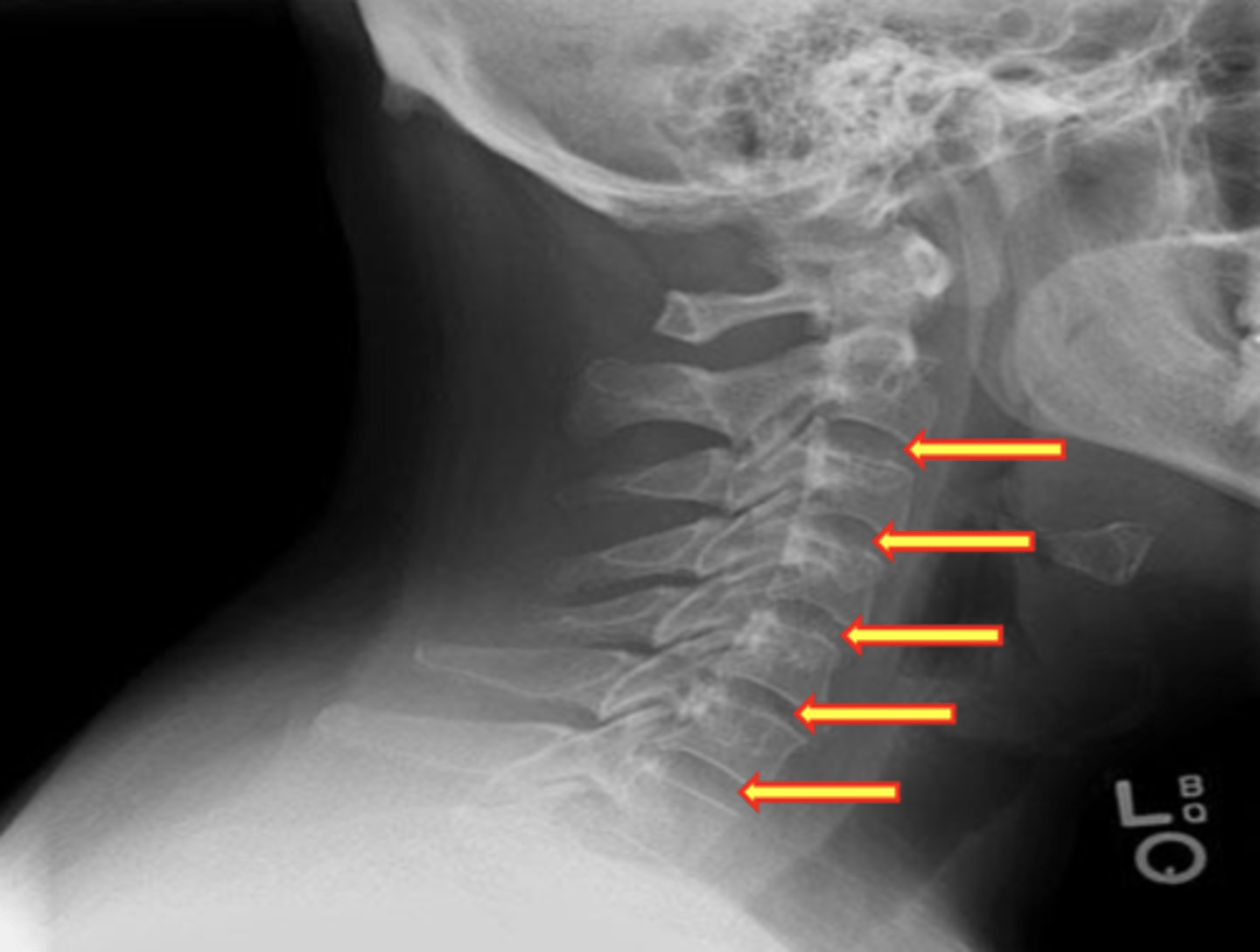 <p>What are the yellow arrows pointing to?</p>