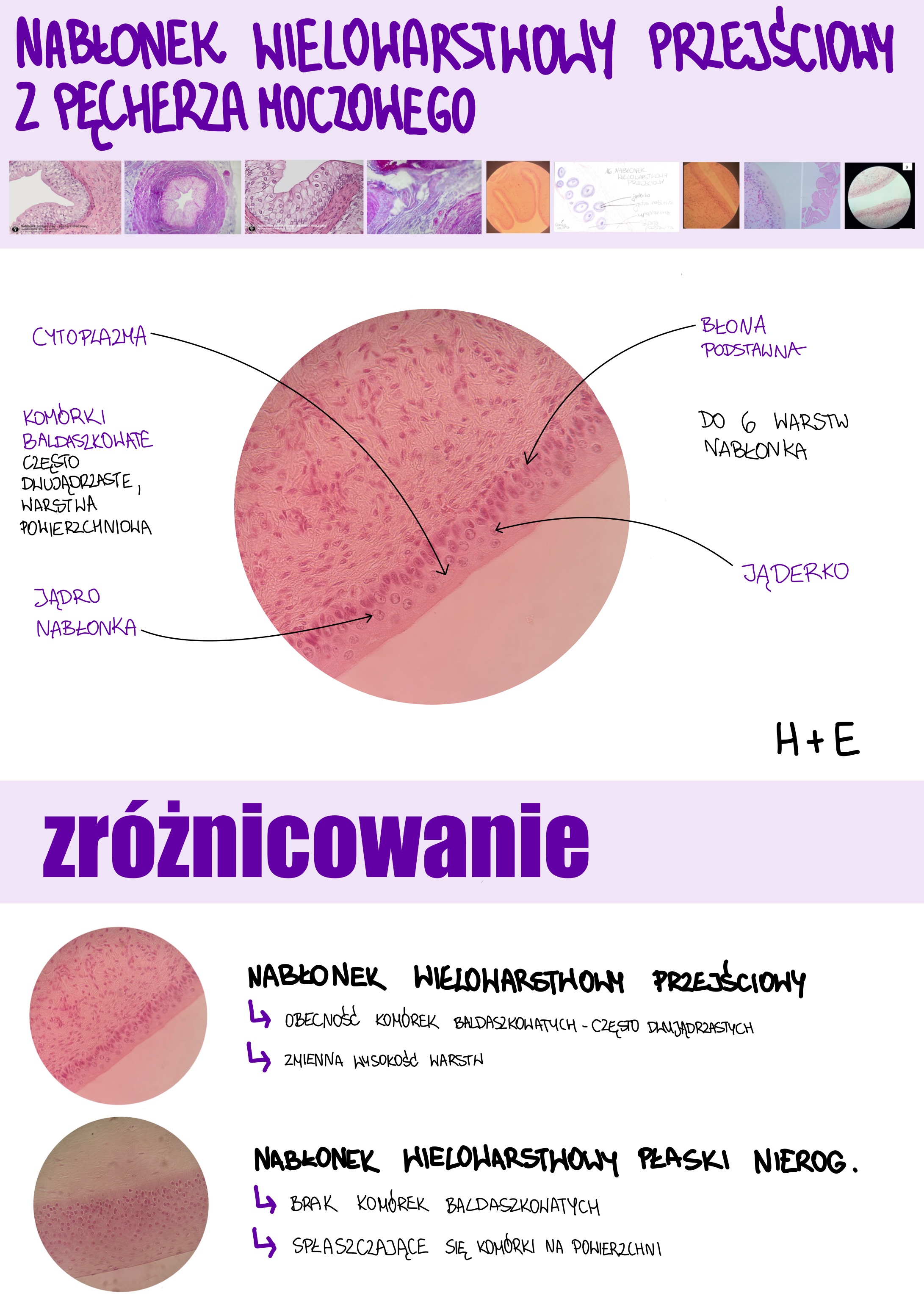<p>Nabłonek wielowarstwowy przejściowy z pęcherza moczowego</p>