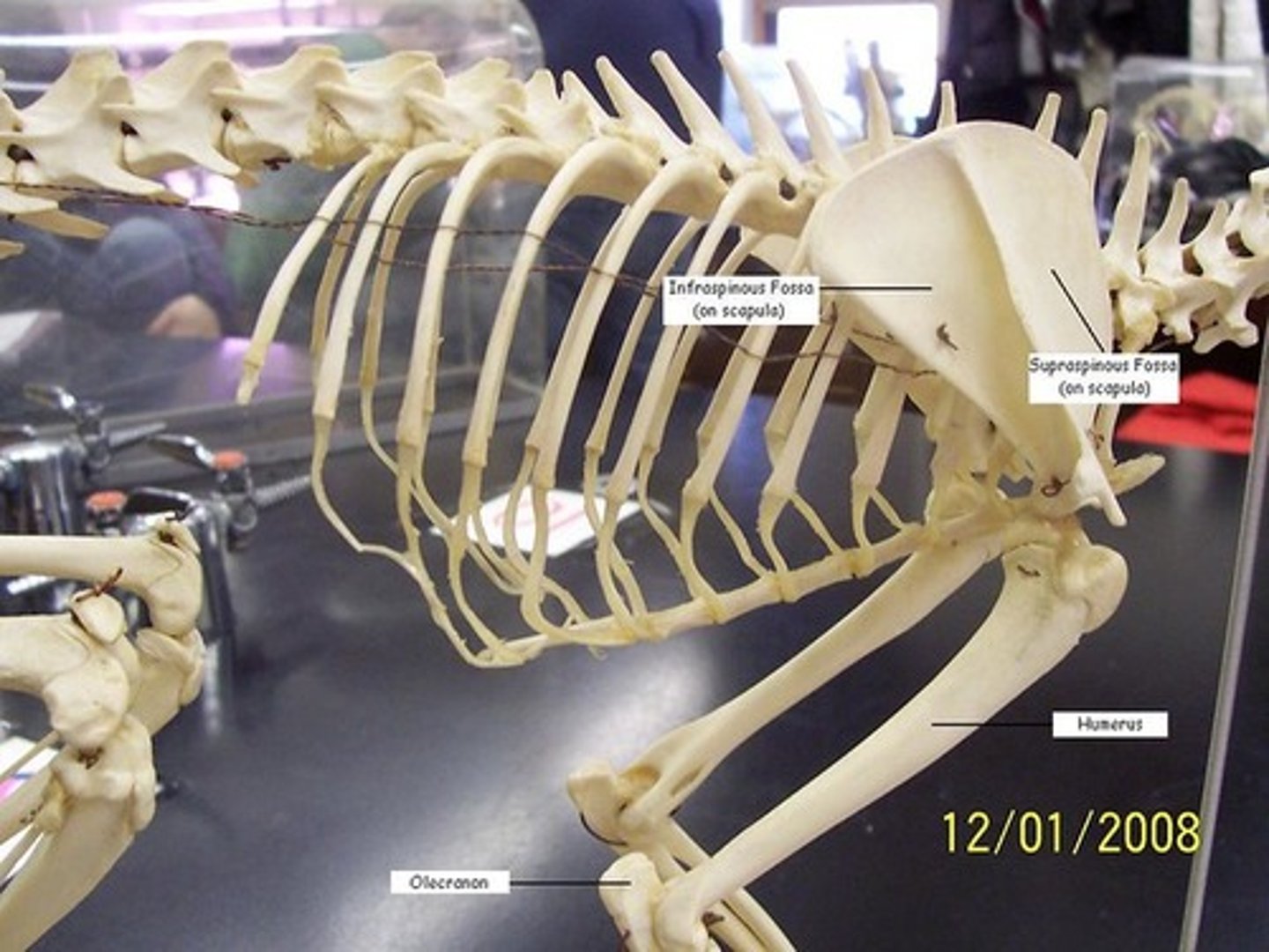 <p>Supraspinous fossa</p><p>Infraspinous fossa</p>
