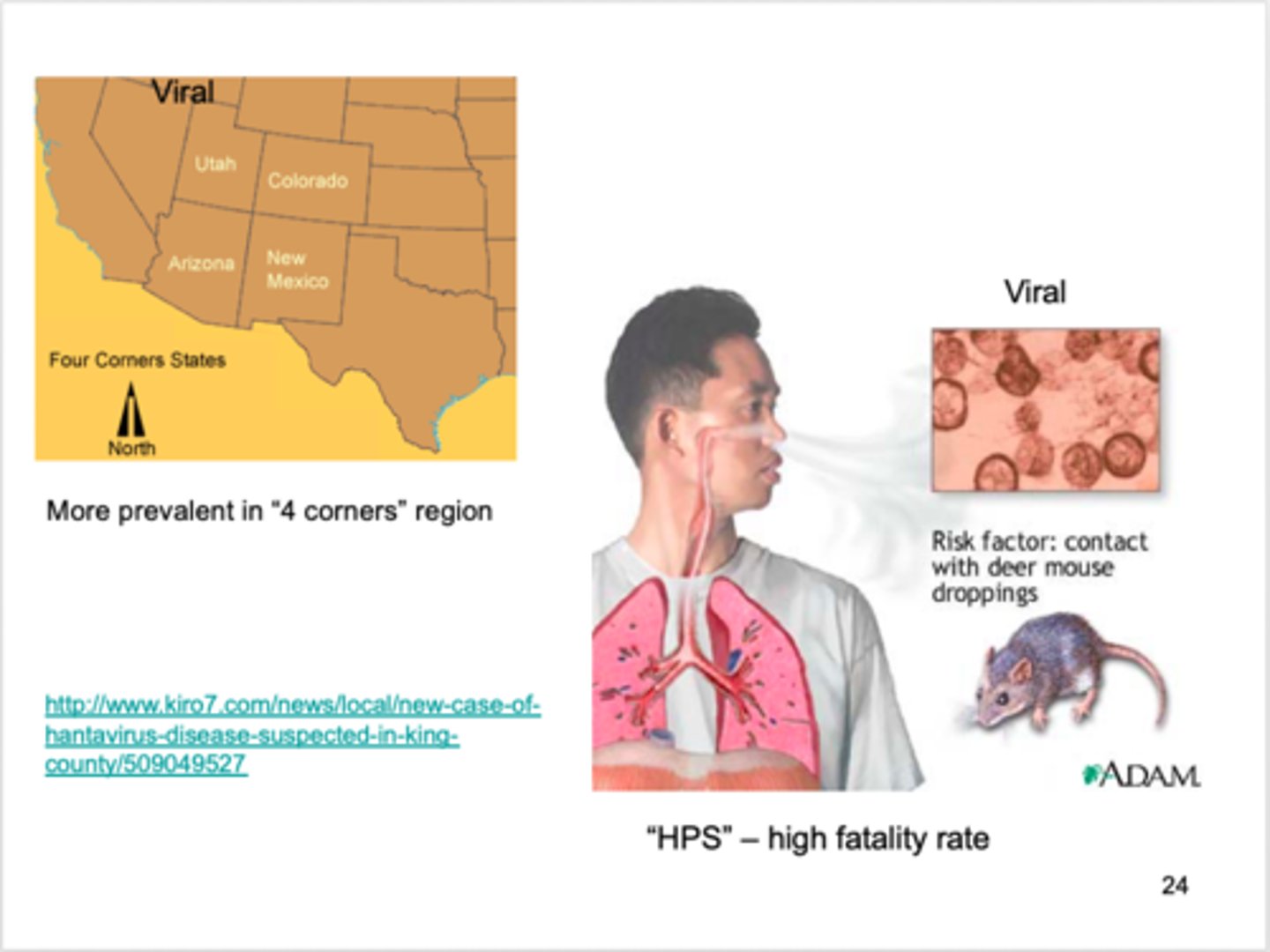 <p>Hantavirus</p>