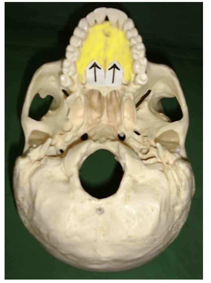 term image