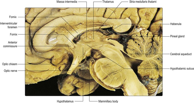 <ul><li><p>Thalamus </p></li><li><p>Interthalamic mass </p></li><li><p>Striae medullaris thalami </p></li><li><p>Habenular nucleus </p></li><li><p>Pineal gland </p></li><li><p>Hypothalamus</p></li></ul><p></p>