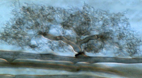 <p>which fungi group is this? is it chytrids, rhizopus stolonifer, or arbuscular mychorrizae, sac fungi, or club fungi?</p>