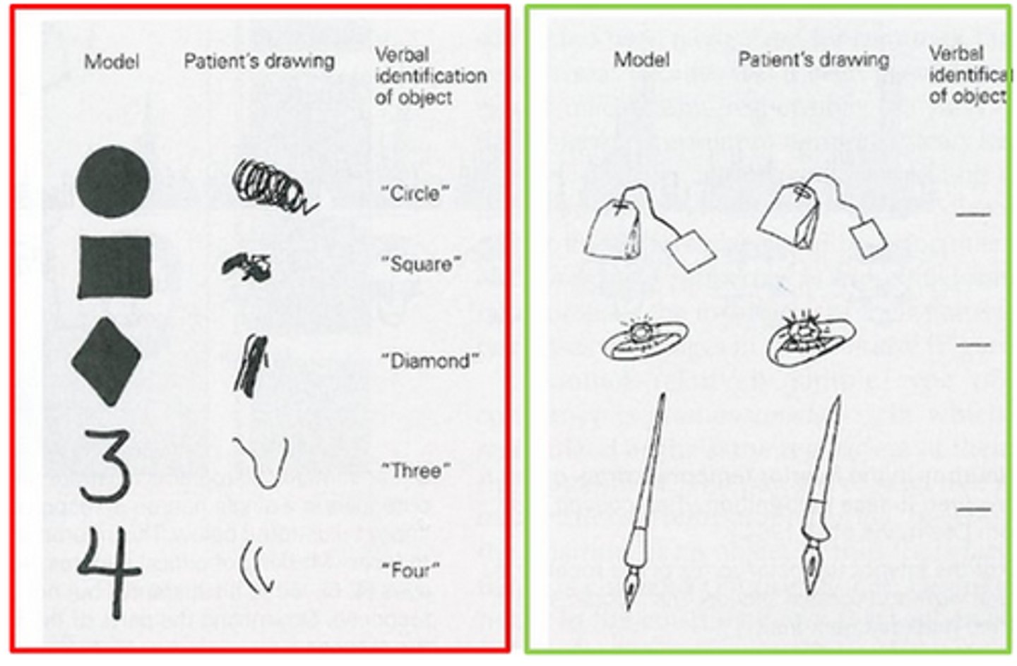 <p>a disorder characterized by the inability to name, copy or recognize visually presented objects. Shape perception and figure-ground segregation is impaired, but basic visual functions (color discrimination, luminance discrimination, visual acuity) and object identification based on non-visual cues are preserved</p>