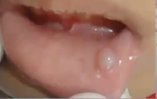 <p>What is the diagnosis?</p>
