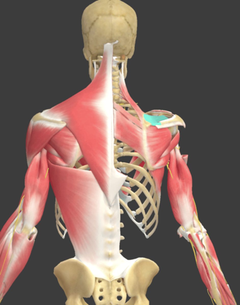 <p>What Muscle Is Highlighted?</p>