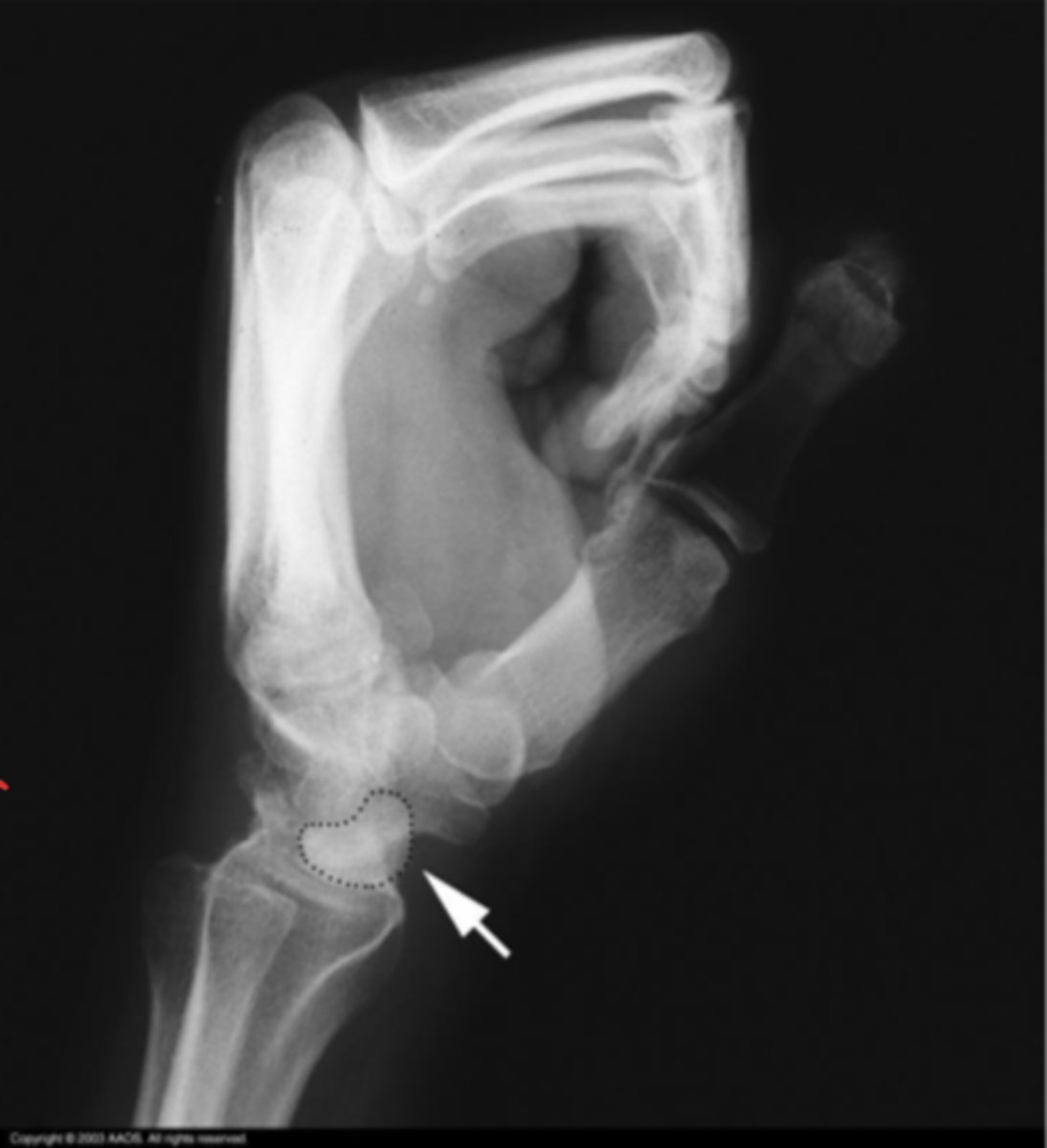 <p>What is the issue?</p>