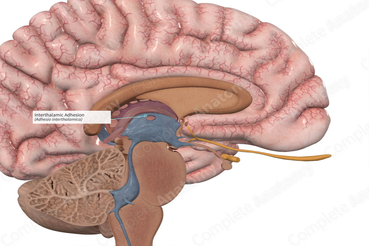 <p>A bridge of neural tissue that connects the medial surfaces of the two thalami, crossing the third ventricle in the center of the brain</p>