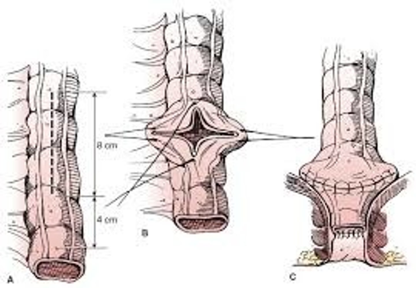 <p>plastic repair of the vagina</p>