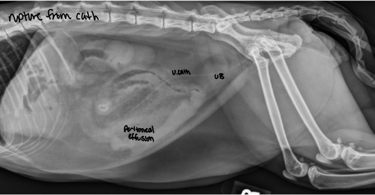 <ul><li><p>air embolism</p></li><li><p>trauma</p></li><li><p>bladder rupture</p></li><li><p>hemorrhage from distention of diseased bladder wall</p></li><li><p>catheter kinking/knot</p></li><li><p>bacterial contamination</p></li></ul><p></p>
