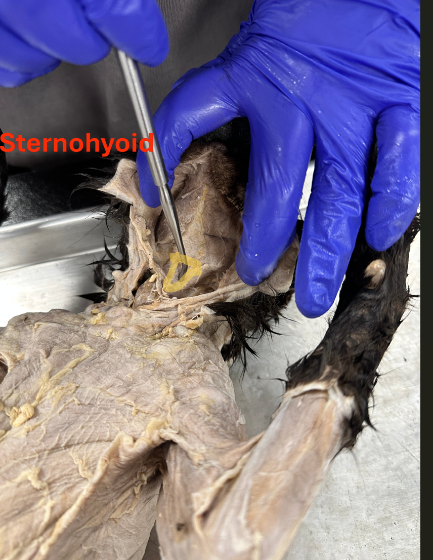 <p>sternohyoid (<strong>STER-no-HY-oid) (neck muscle)</strong></p>