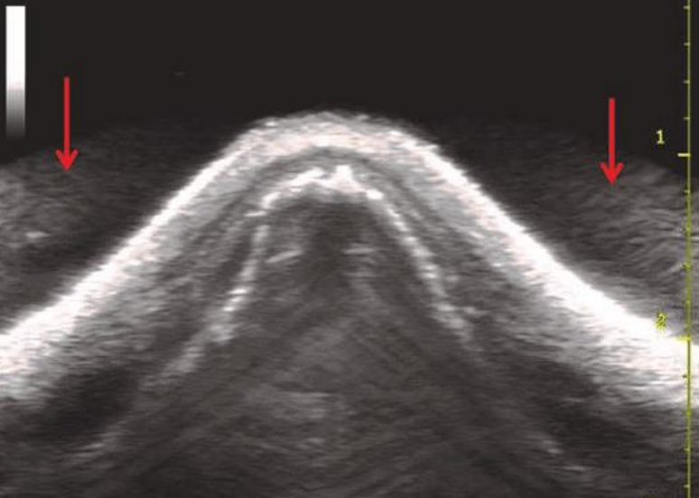 <p>what type of artifact is this?</p>