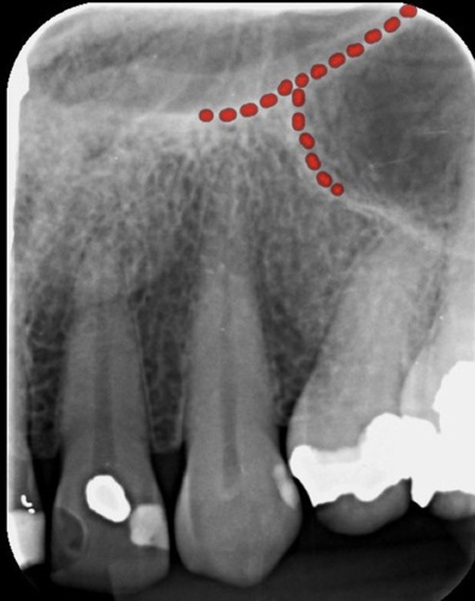 knowt flashcard image