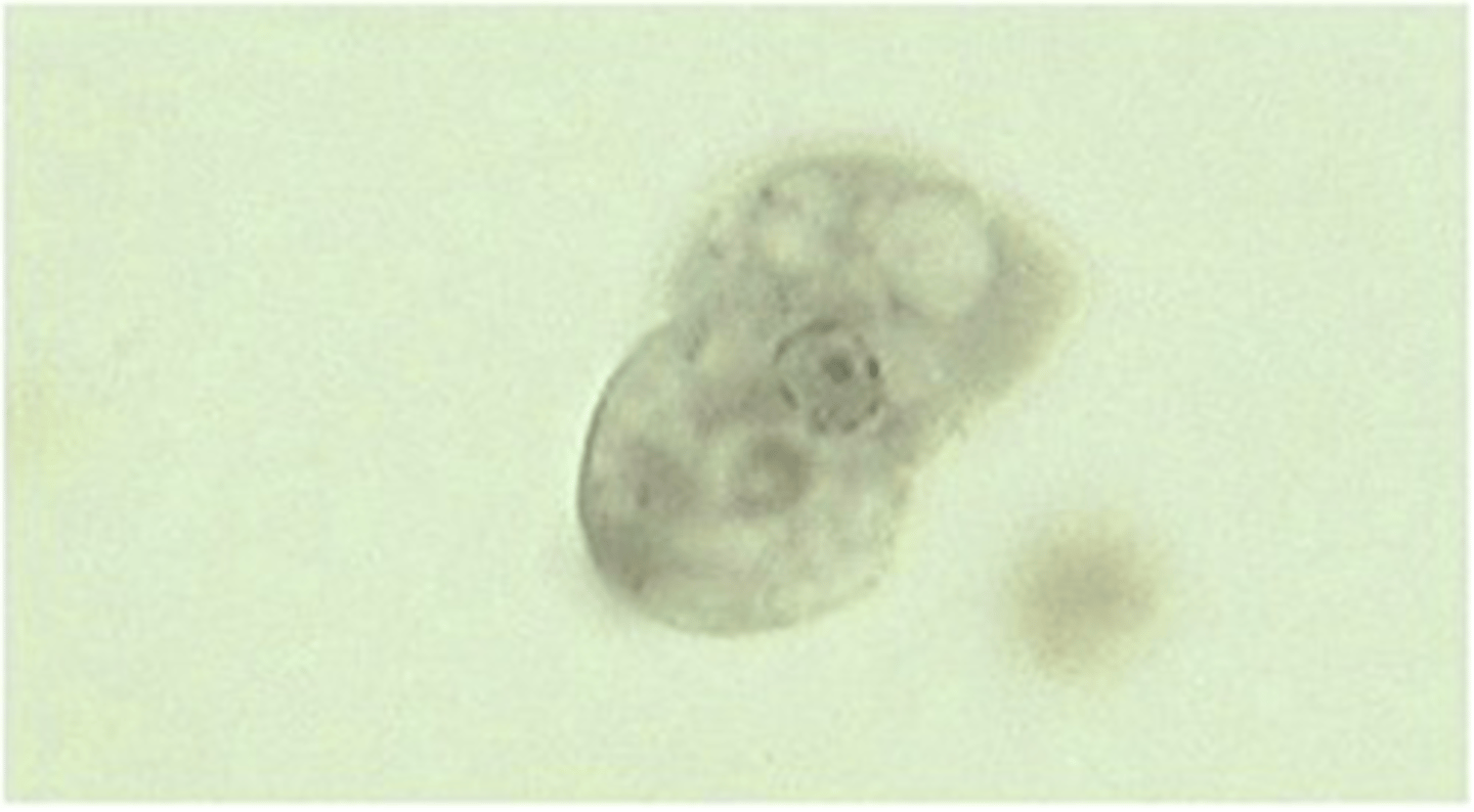 <p>This trophozoite stage of the phylum Sarcomastigophora, subphylum Sarcodina, is seen in</p><p>dogs, cats, primates, and humans. Identify this protozoan parasite.</p>