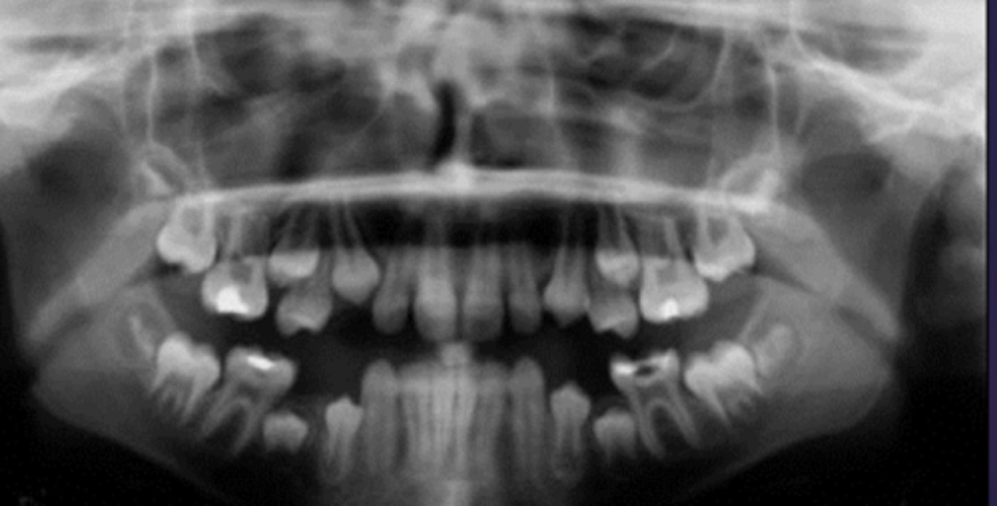 <p>whats the age</p><p>5-6</p><p>7-8</p><p>9-10</p><p>11-12</p>