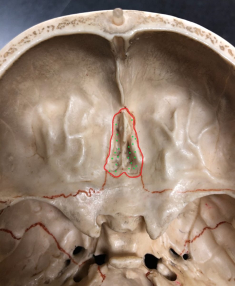 <p>Holes in cribriform plate</p><p>(the green dots on the pic)</p>