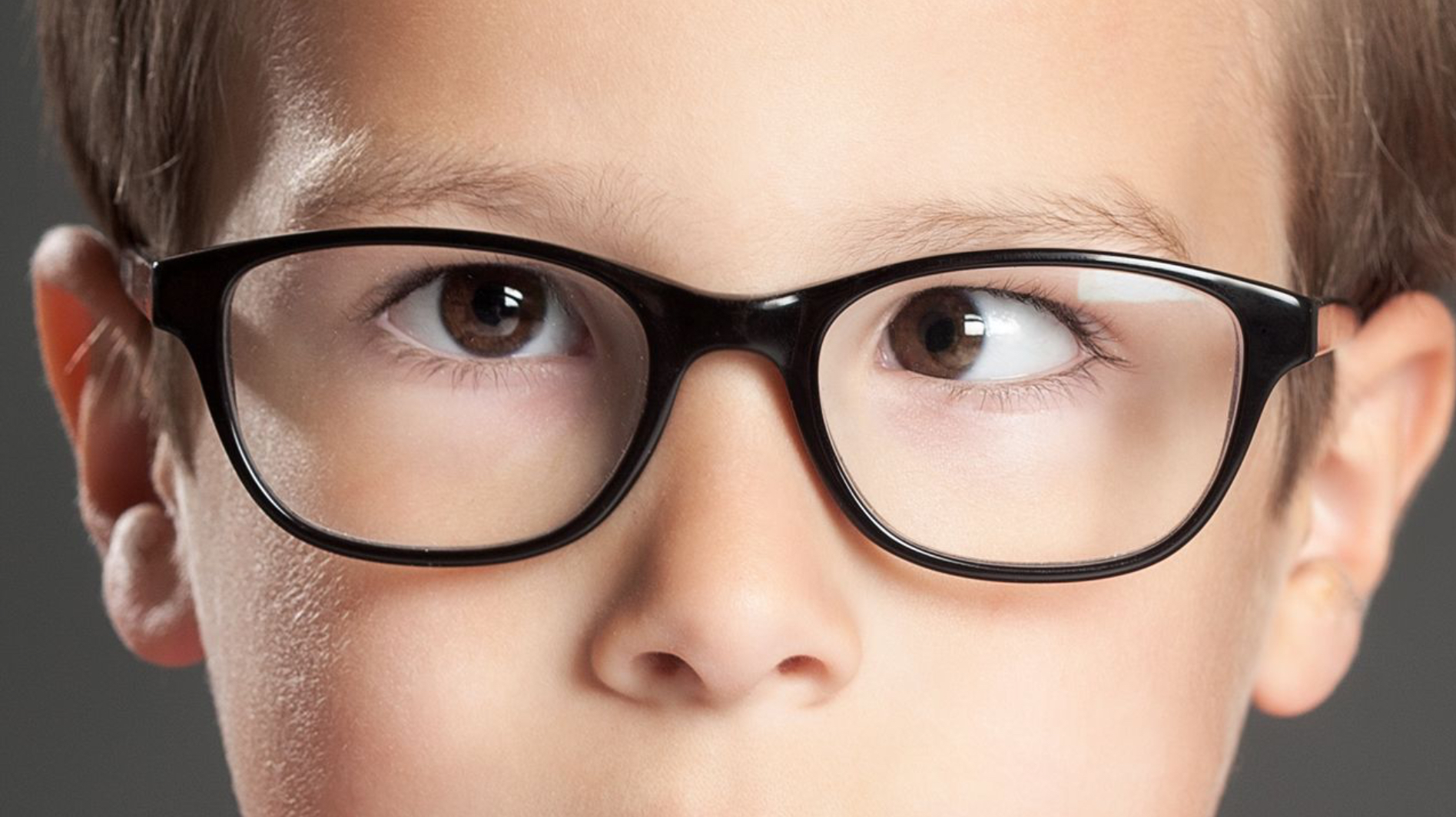 <p>Misalignment of the eyes caused by neuromuscular imbalance (Deviated gaze)</p>