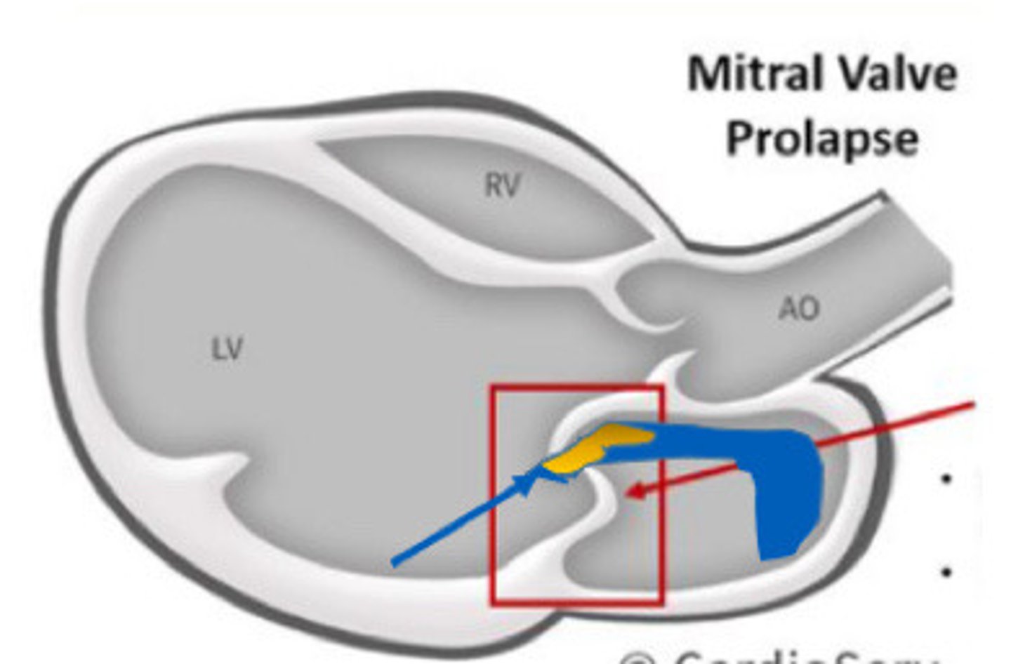 <p>What is this image demonstrating</p>