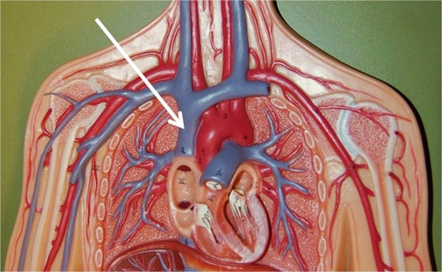 <p>The ______ is a vein that carries blood that has had the oxygen removed from it, to the right part of the heart.</p>