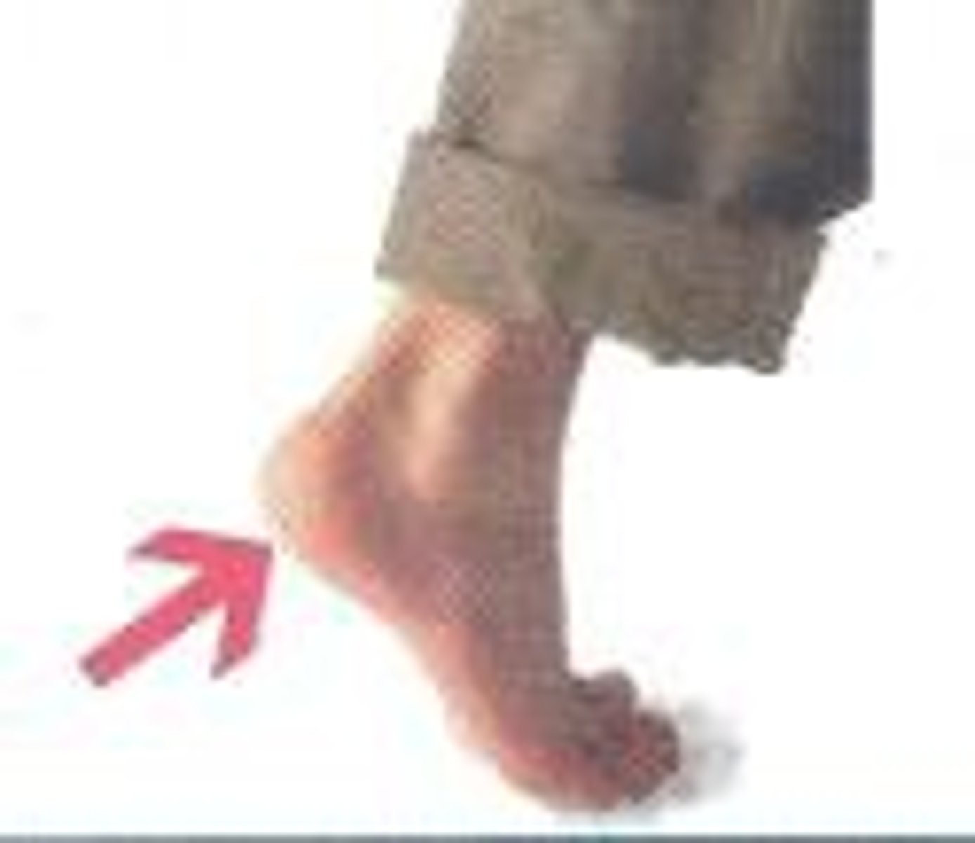 <p>pertaining to the heel</p>