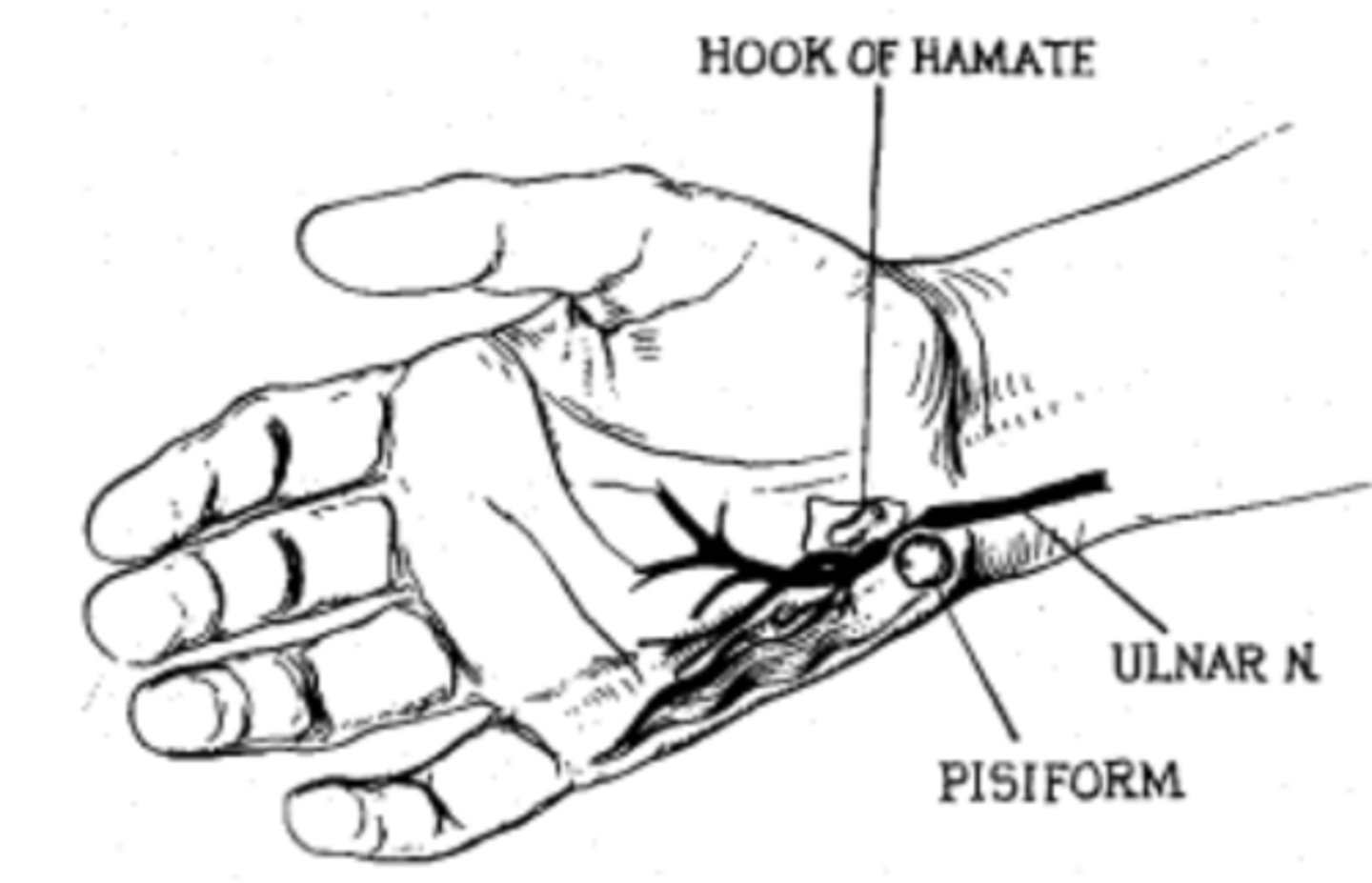 <p>os hamatum és os pisiforme között</p>