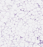 <p>What connective tissue cell is shown in the following image?</p>