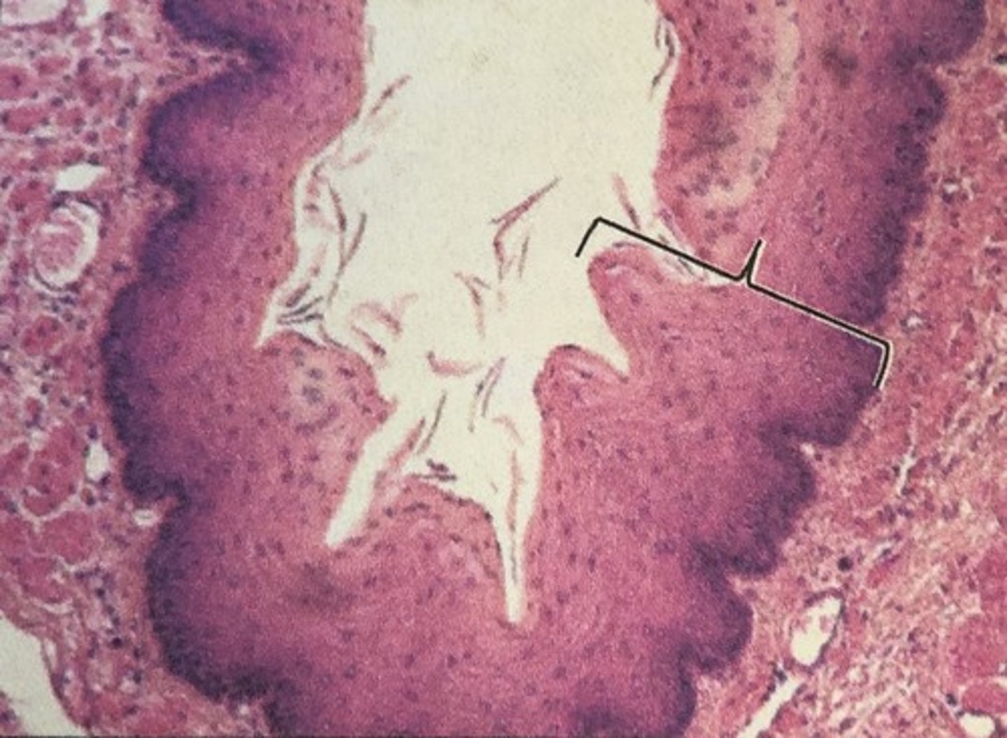 <p>Epithelium (transitions to this type of tissue) near urethra opening is made of-</p>