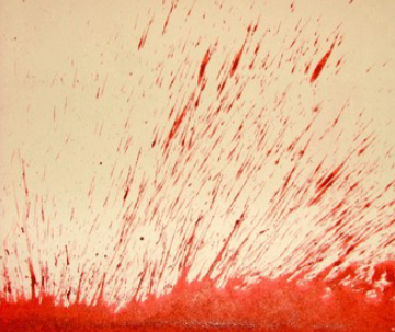 <p>What bloodstain pattern is this?</p>