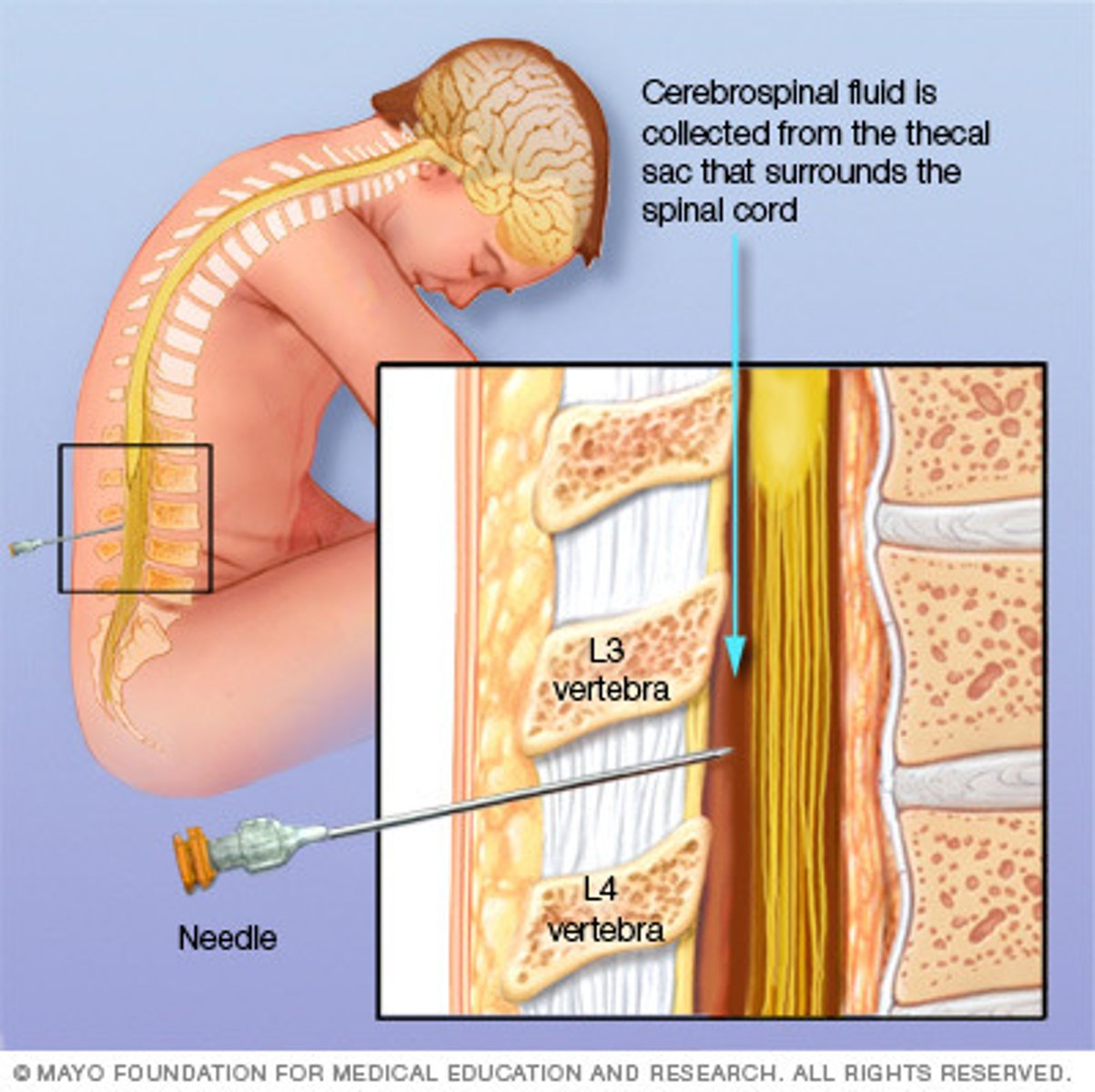 <p>subarachnoid space</p>