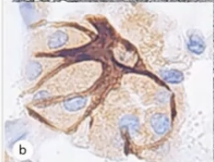 <p>What are myoepithelial cells?</p>