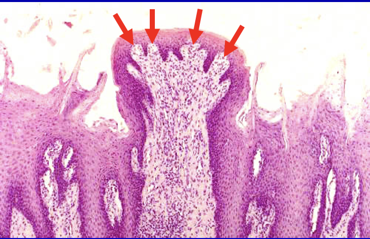 <p><span>–Anterior tongue</span></p><p><span>–Mushroom-shaped</span></p><p><span>–Taste buds</span></p><p><span>•Apical surface</span></p>