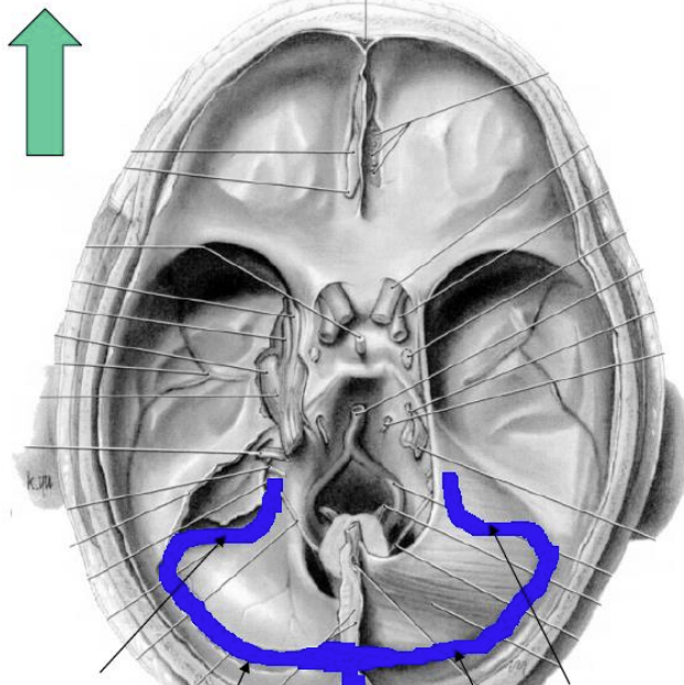 <p>What are these two sinuses?</p>