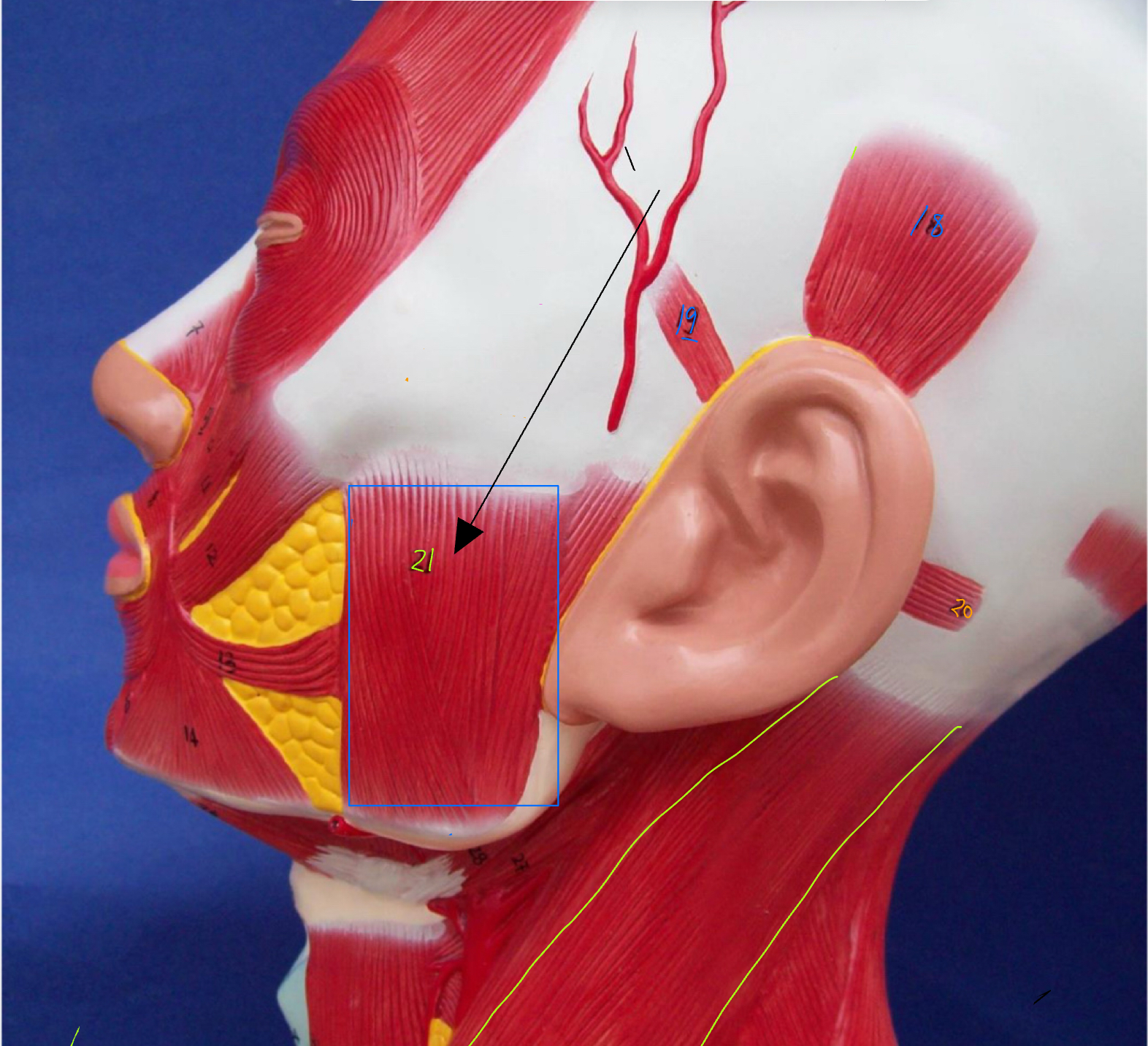 <p>What type of muscle is this (altay model )</p>