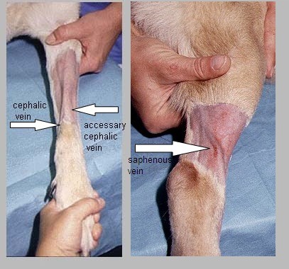 Cephalic venipuncture