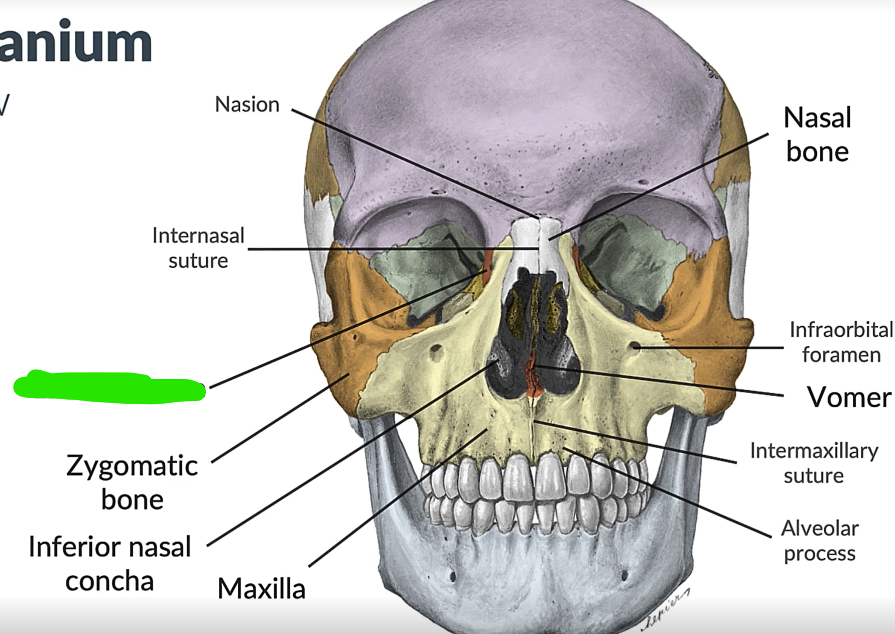 term image