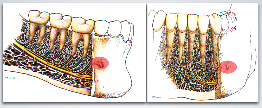 <p>target site for which nerve block?</p>