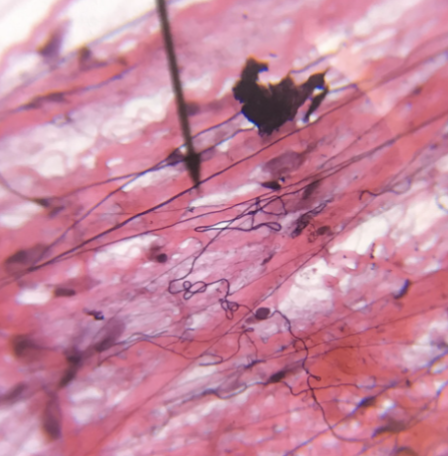 <p>what type of tissue is this </p>