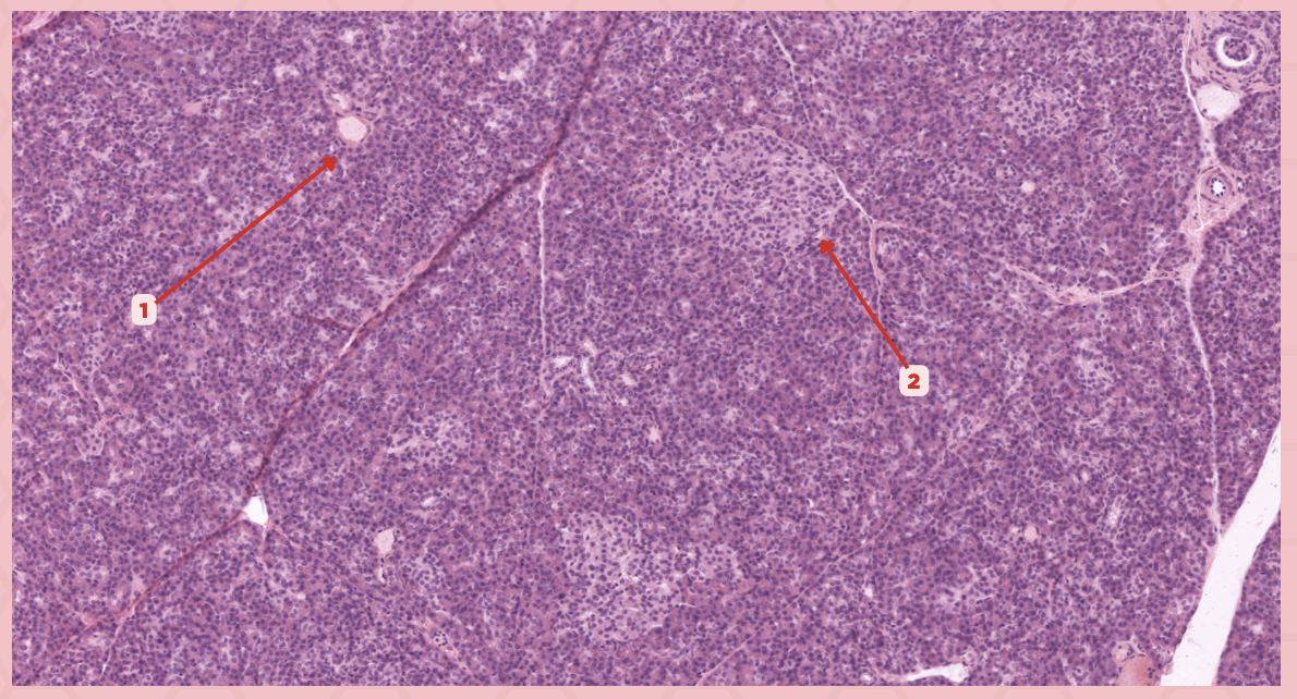 <p>Identify the structure labeled as 2.</p>