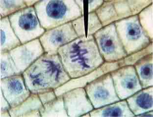 <p>What phase is this cell in?</p>