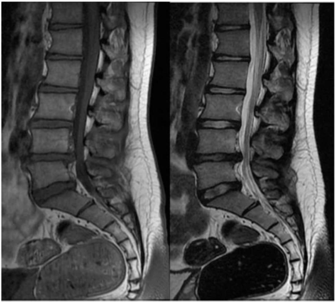 <p>Name this pathology. </p>