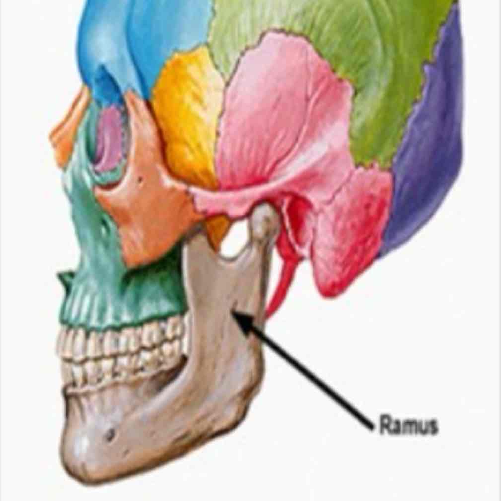 <p>cat #1 / “off-short”: arm-like bar / mandibular ramus</p>