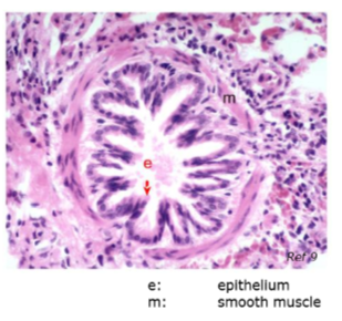 <ul><li><p>epithelium with Clara/Club cells</p></li></ul><p></p>