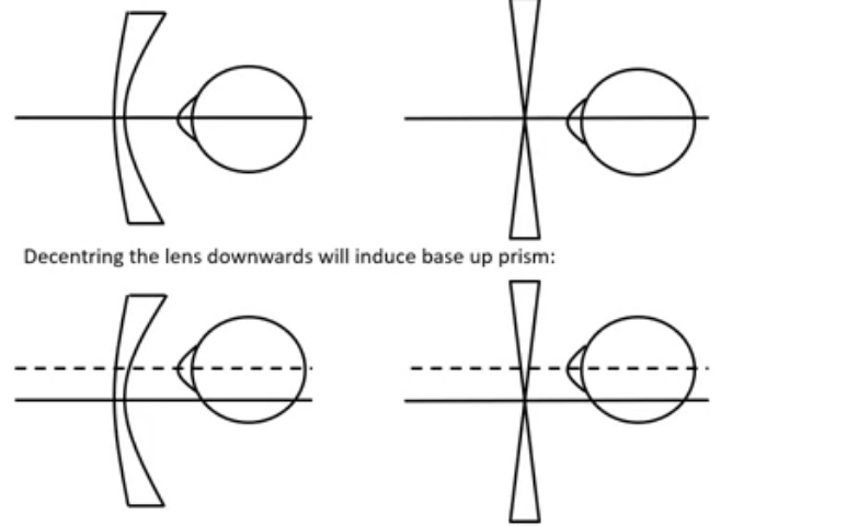 <p>decentering a negative&nbsp; lens&nbsp;</p>