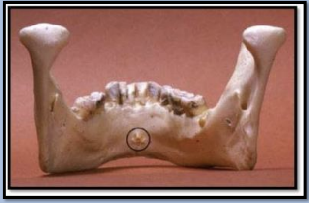 <p>Tubercle: small rounded projection, small bump or nodule of bone </p>
