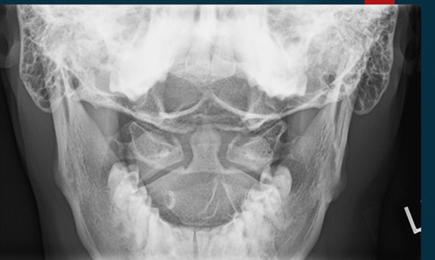 <p>What projection view is this?</p>